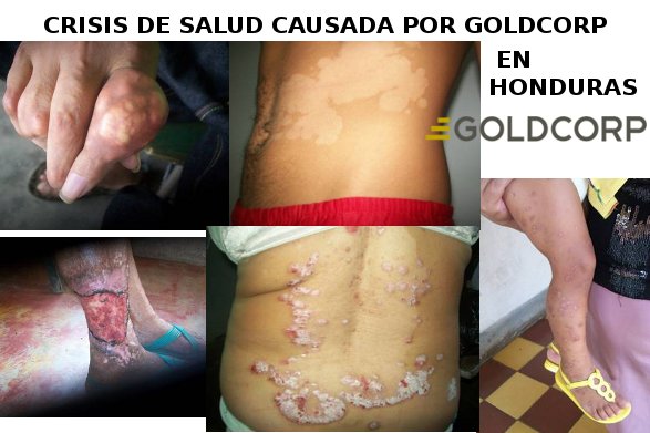 Daños a la salud por Goldcorp en Honduras según el sitio de internet http://www.movimientom4.org/